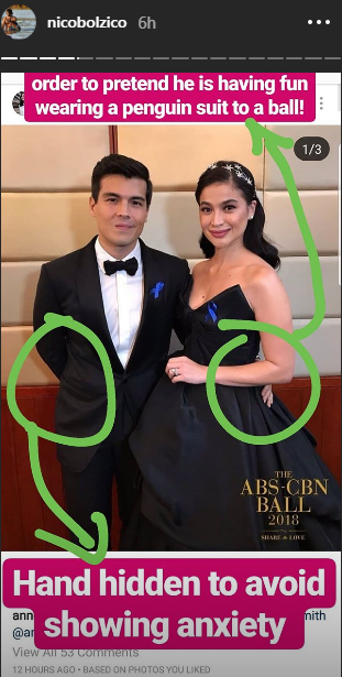 Did Erwan Heussaff survive his first ABS CBN ball Preen.ph